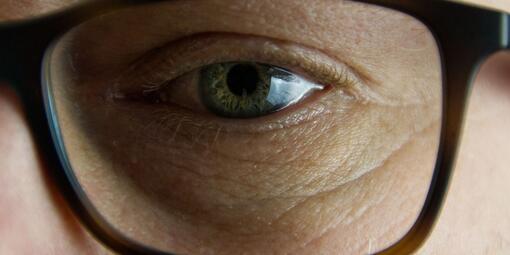 Ein Auge. Davor ein Brillenglas. 