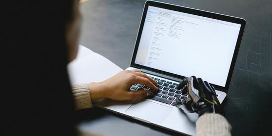 Ein aufgeklappter Laptop auf dem zwei Hände tippen. Die rechte Hand ist eine Prothese. 